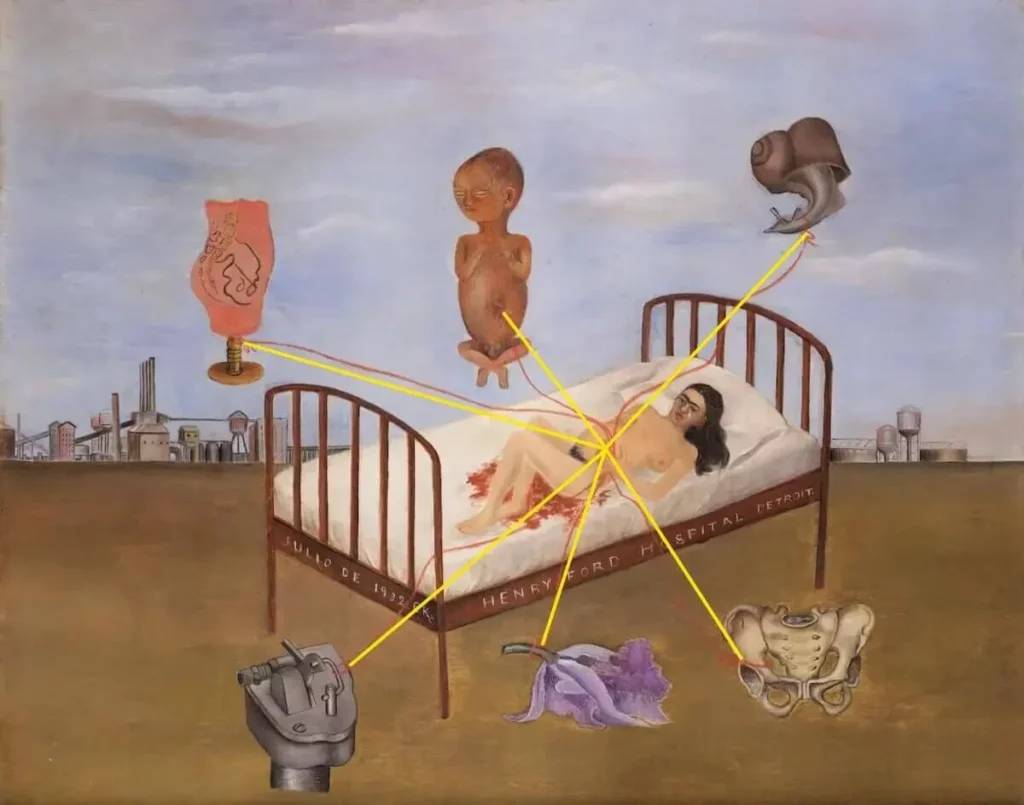 « Henry Ford Hospital (1932), peinture de Frida Kahlo représentant l’artiste allongée sur un lit d’hôpital, entourée de symboles reliés par des fils rouges. »